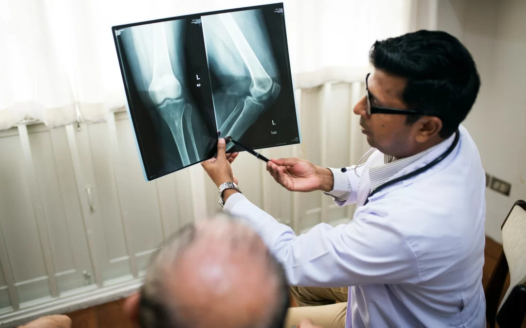 Knee Replacement Surgery Recovery: Your Complete Guide to Healing