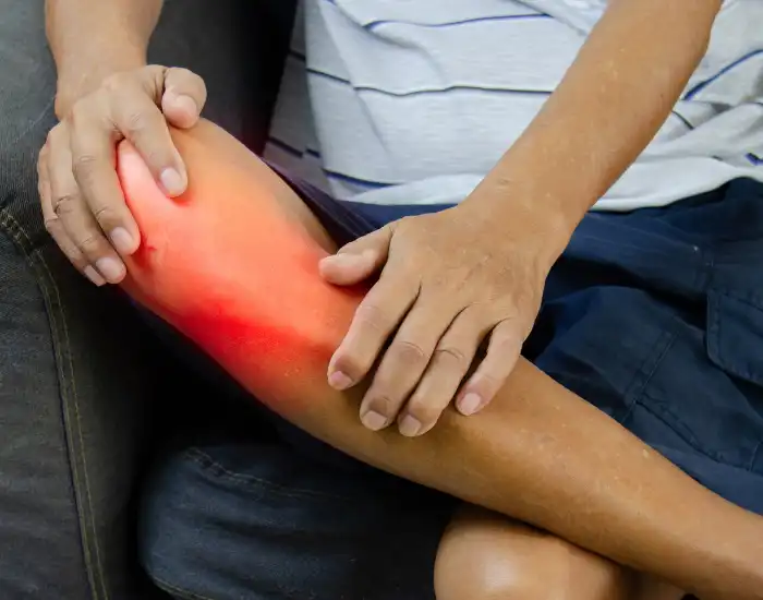 ACL Injury