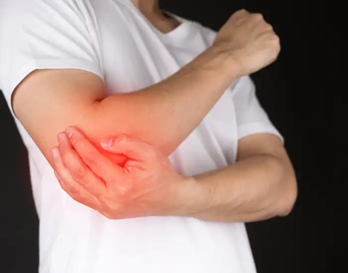 Bursitis