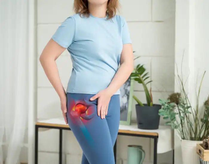Hip Bursitis